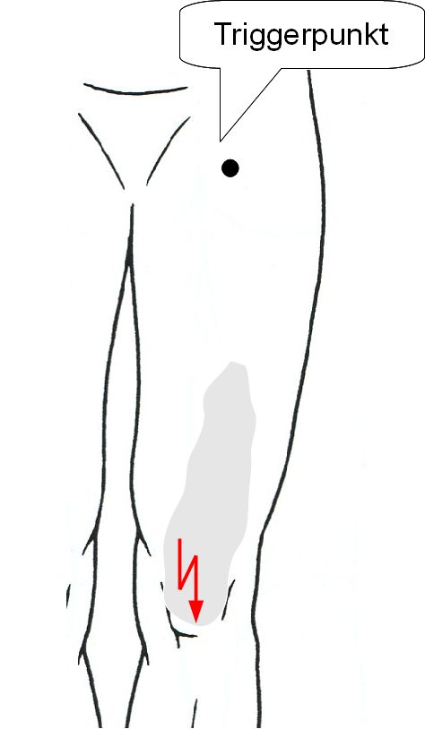 Knie3